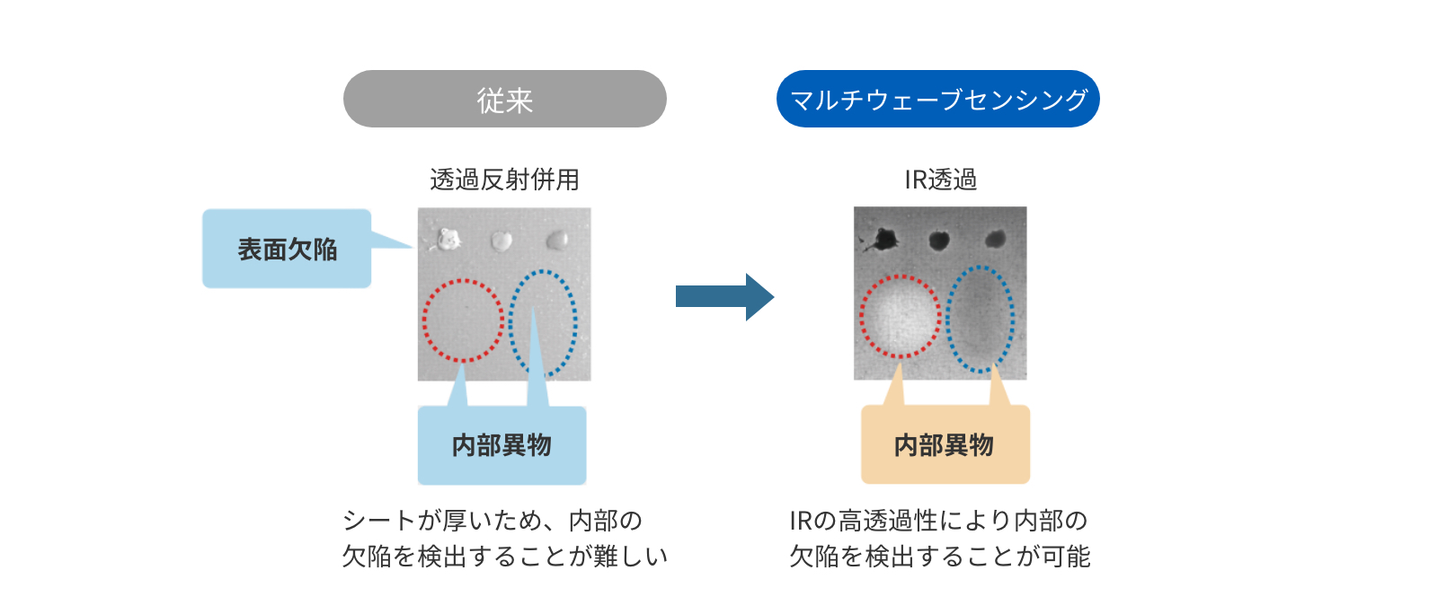 内部異物を検出